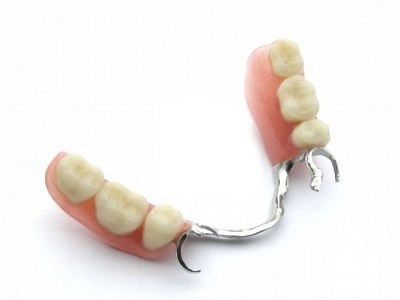 Protesis-dentales-fijas-sobre-implantes