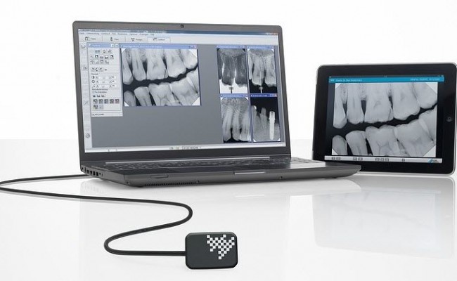 detectores-radiografia-digital-dental-intraorales-72550-3684005