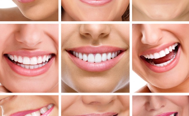 teeth collage of people smiles